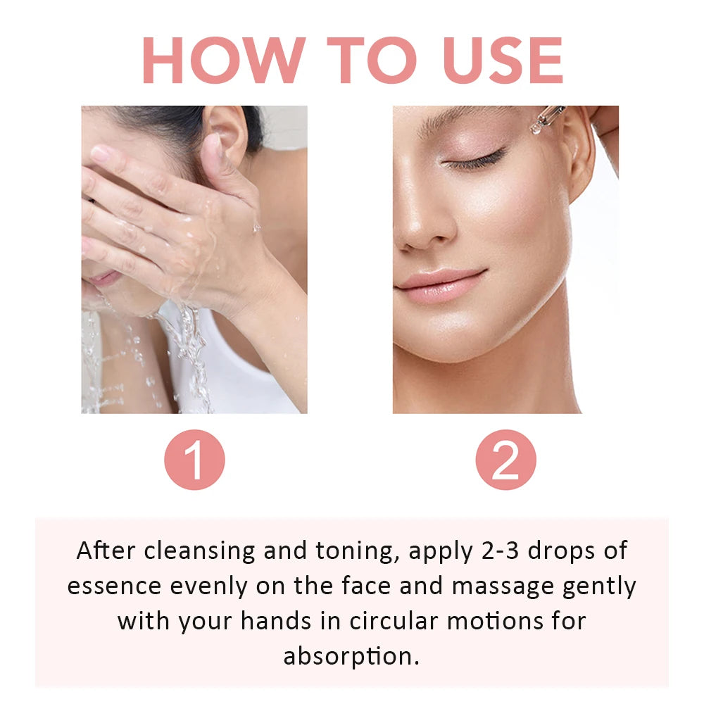 ✨ 30ml Niacinamide Serum – Fade Dark Spots & Brighten Skin