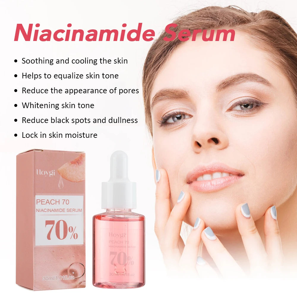 ✨ 30ml Niacinamide Serum – Fade Dark Spots & Brighten Skin
