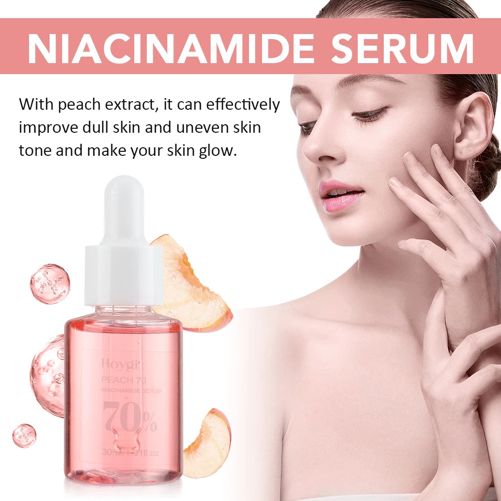 ✨ 30ml Niacinamide Serum – Fade Dark Spots & Brighten Skin