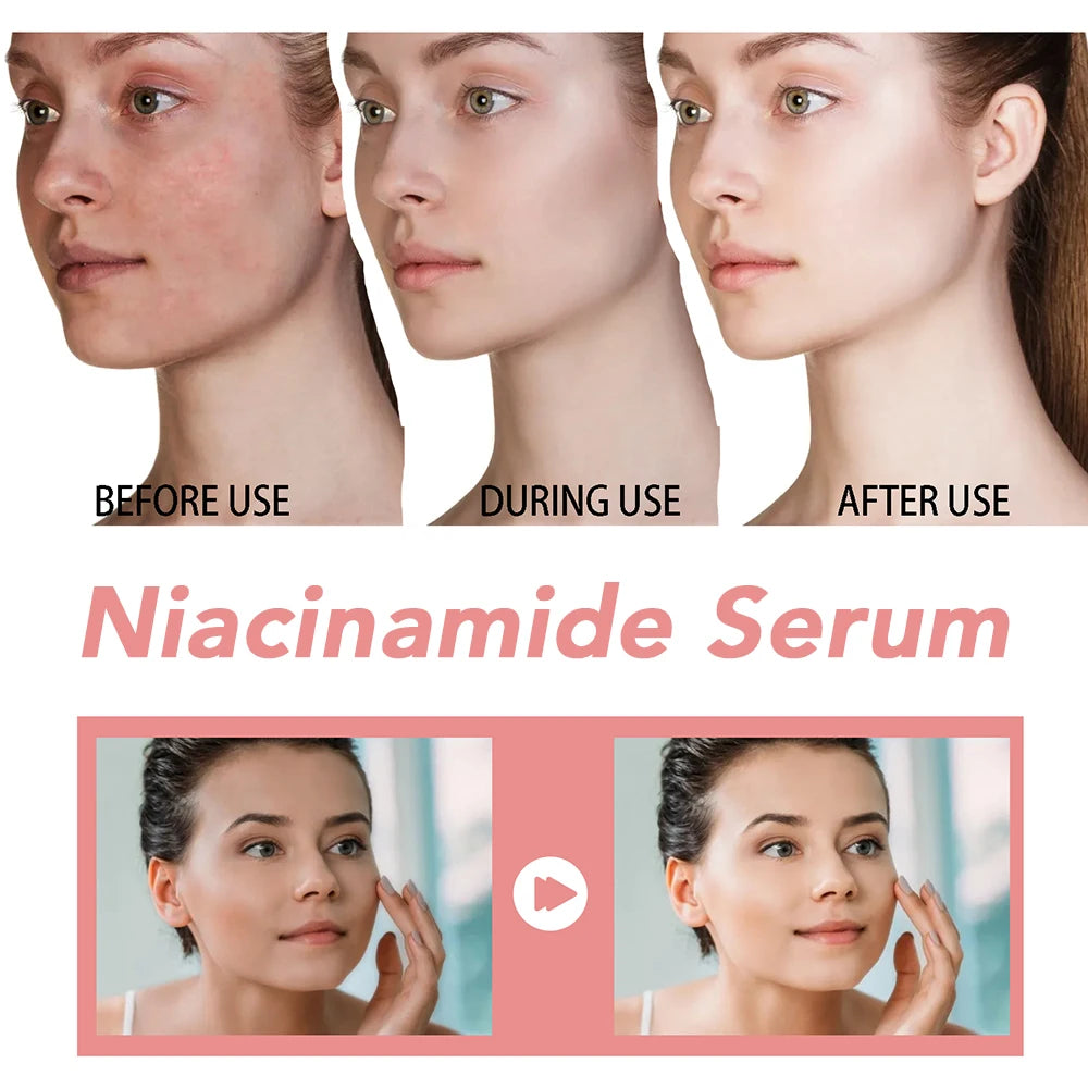 ✨ 30ml Niacinamide Serum – Fade Dark Spots & Brighten Skin
