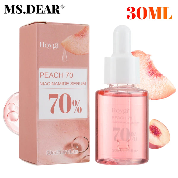 ✨ 30ml Niacinamide Serum – Fade Dark Spots & Brighten Skin