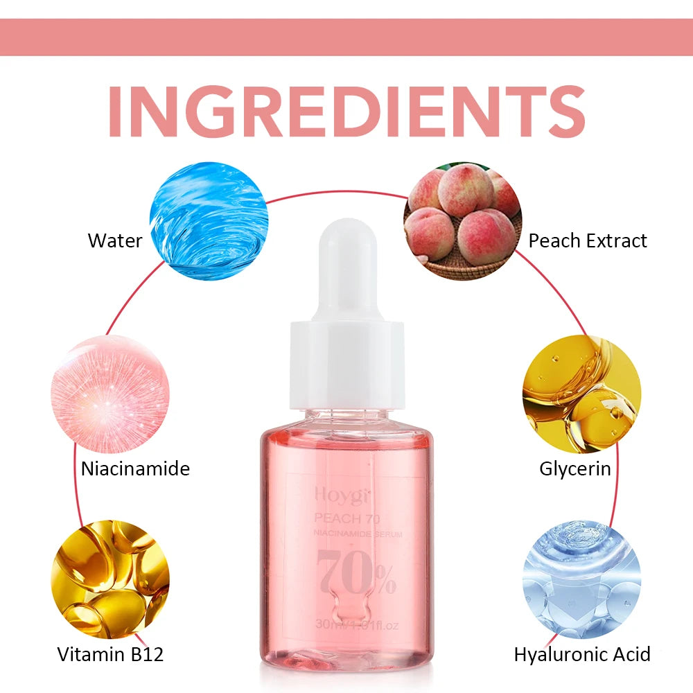 ✨ 30ml Niacinamide Serum – Fade Dark Spots & Brighten Skin