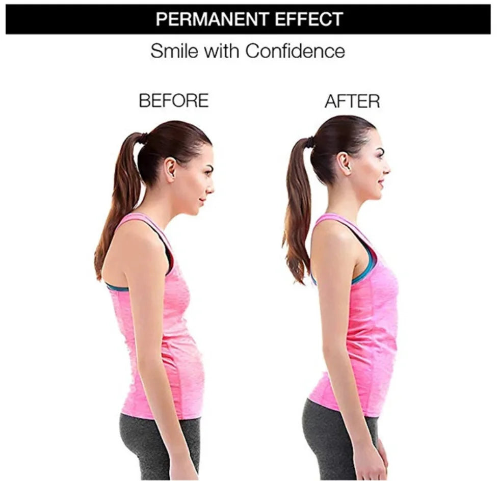 Adjustable Back Shoulder Posture Corrector Belt – Align Your Spine & Boost Confidence