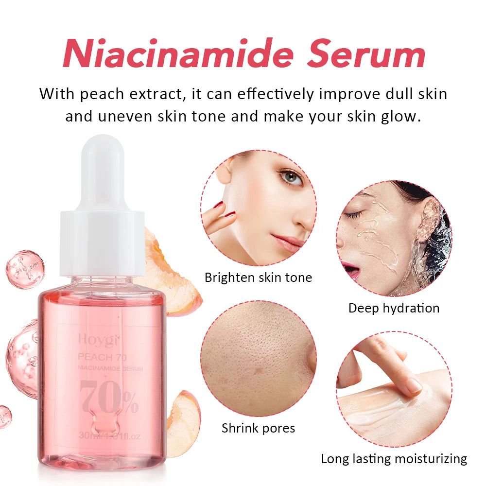 ✨ 30ml Niacinamide Serum – Fade Dark Spots & Brighten Skin